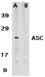 Western blot - ASC Antibody from Signalway Antibody (24111) - Antibodies.com