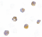 Immunocytochemistry of ASC in HL60 cells with ASC antibody at 5 µg/mL.