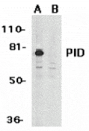 Western blot - PID Antibody from Signalway Antibody (24139) - Antibodies.com