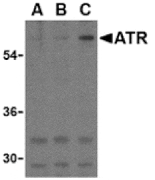 Western blot - ATR Antibody from Signalway Antibody (24189) - Antibodies.com