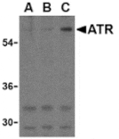 Western blot - ATR Antibody from Signalway Antibody (24189) - Antibodies.com