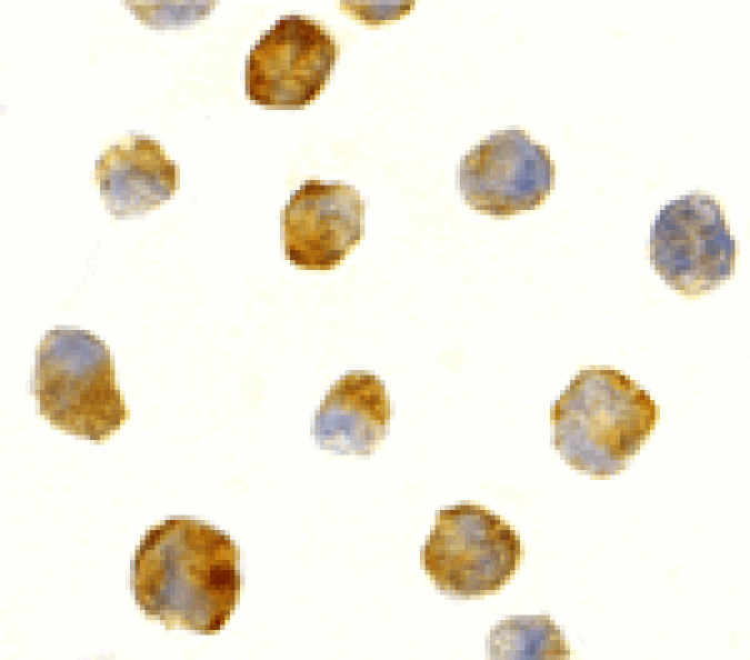 Immunocytochemistry - ATR Antibody from Signalway Antibody (24189) - Antibodies.com