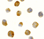 Immunocytochemistry - ATR Antibody from Signalway Antibody (24189) - Antibodies.com