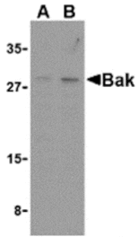Western blot - Bak Antibody from Signalway Antibody (24249) - Antibodies.com