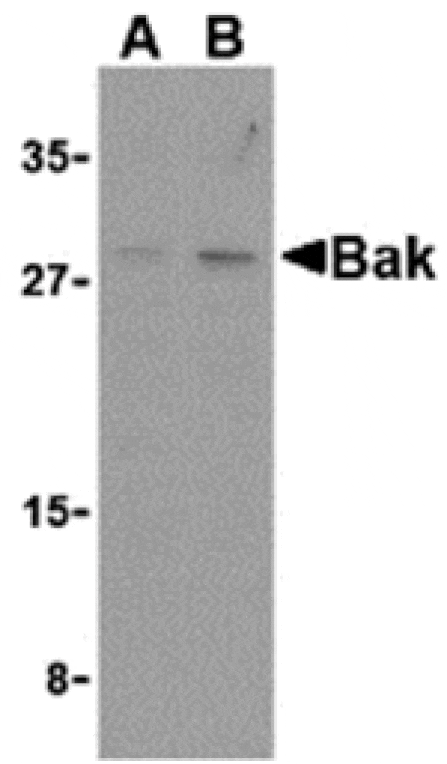 Western blot - Bak Antibody from Signalway Antibody (24249) - Antibodies.com