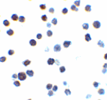 Immunocytochemistry - Bak Antibody from Signalway Antibody (24249) - Antibodies.com