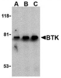Western blot - BTK Antibody from Signalway Antibody (24263) - Antibodies.com