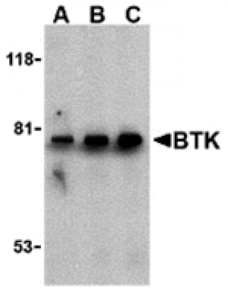 Western blot - BTK Antibody from Signalway Antibody (24263) - Antibodies.com