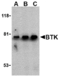Western blot - BTK Antibody from Signalway Antibody (24263) - Antibodies.com