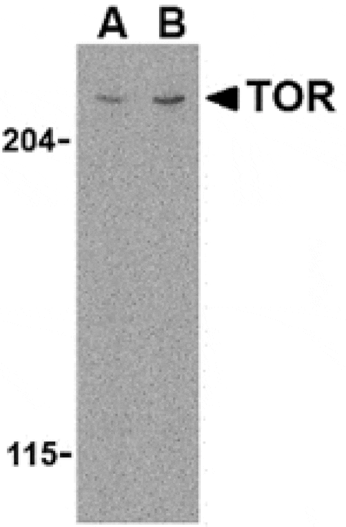 Western blot - TOR Antibody from Signalway Antibody (24301) - Antibodies.com