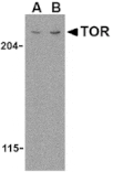 Western blot - TOR Antibody from Signalway Antibody (24301) - Antibodies.com