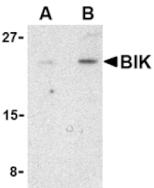 Western blot - Bik Antibody from Signalway Antibody (24421) - Antibodies.com