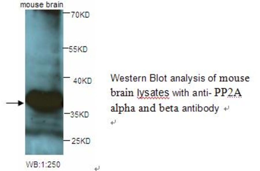 PP2A alpha and beta Antibody from Signalway Antibody (39248) - Antibodies.com