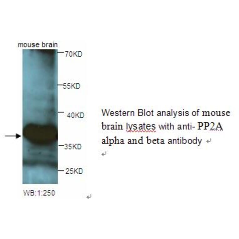 PP2A alpha and beta Antibody from Signalway Antibody (39248) - Antibodies.com