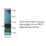 PP2A alpha and beta Antibody from Signalway Antibody (39248) - Antibodies.com