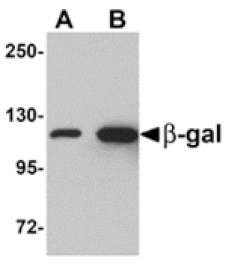 Western blot - beta-Galactosidase Antibody from Signalway Antibody (24889) - Antibodies.com