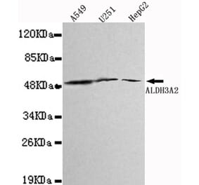 Western blot - ALDH3A2 Monoclonal Antibody from Signalway Antibody (27108) - Antibodies.com