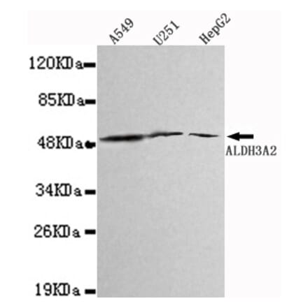 Western blot - ALDH3A2 Monoclonal Antibody from Signalway Antibody (27108) - Antibodies.com