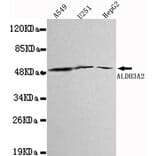 Western blot - ALDH3A2 Monoclonal Antibody from Signalway Antibody (27108) - Antibodies.com