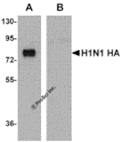 Seasonal H1N1 Hemagglutinin Monoclonal Antibody from Signalway Antibody (26042) - Antibodies.com