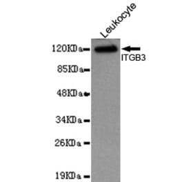 Western blot - Integrin beta 3 (N-terminus) Monoclonal Antibody from Signalway Antibody (27094) - Antibodies.com