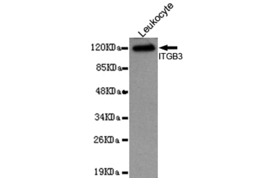 Western blot - Integrin beta 3 (N-terminus) Monoclonal Antibody from Signalway Antibody (27094) - Antibodies.com