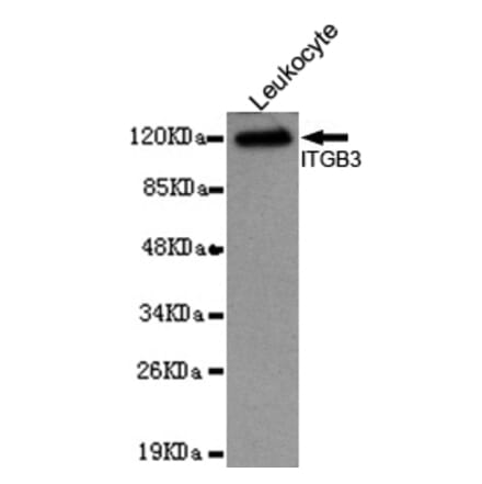 Western blot - Integrin beta 3 (N-terminus) Monoclonal Antibody from Signalway Antibody (27094) - Antibodies.com