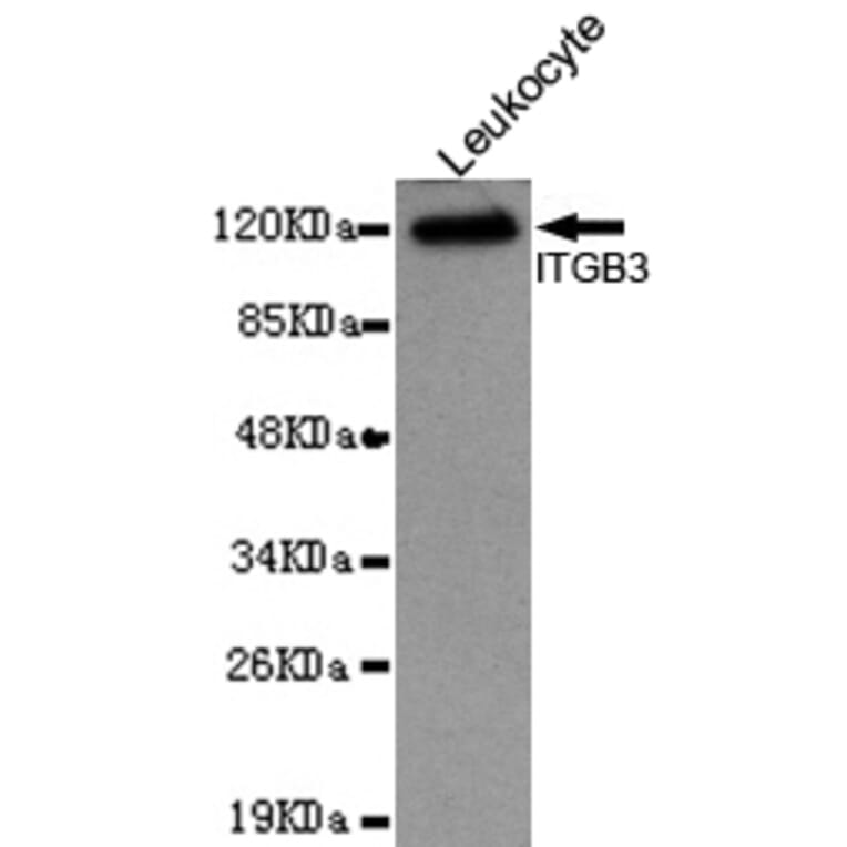 Western blot - Integrin beta 3 (N-terminus) Monoclonal Antibody from Signalway Antibody (27094) - Antibodies.com