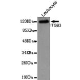 Western blot - Integrin beta 3 (N-terminus) Monoclonal Antibody from Signalway Antibody (27094) - Antibodies.com