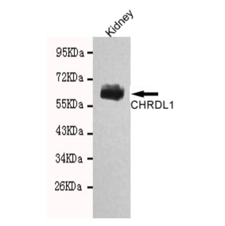 Western blot - CHRDL1 Monoclonal Antibody from Signalway Antibody (27106) - Antibodies.com