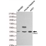 Western blot - CALU-C Monoclonal Antibody from Signalway Antibody (27116) - Antibodies.com