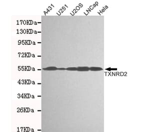 Western blot - TXNRD2 Monoclonal Antibody from Signalway Antibody (27123) - Antibodies.com