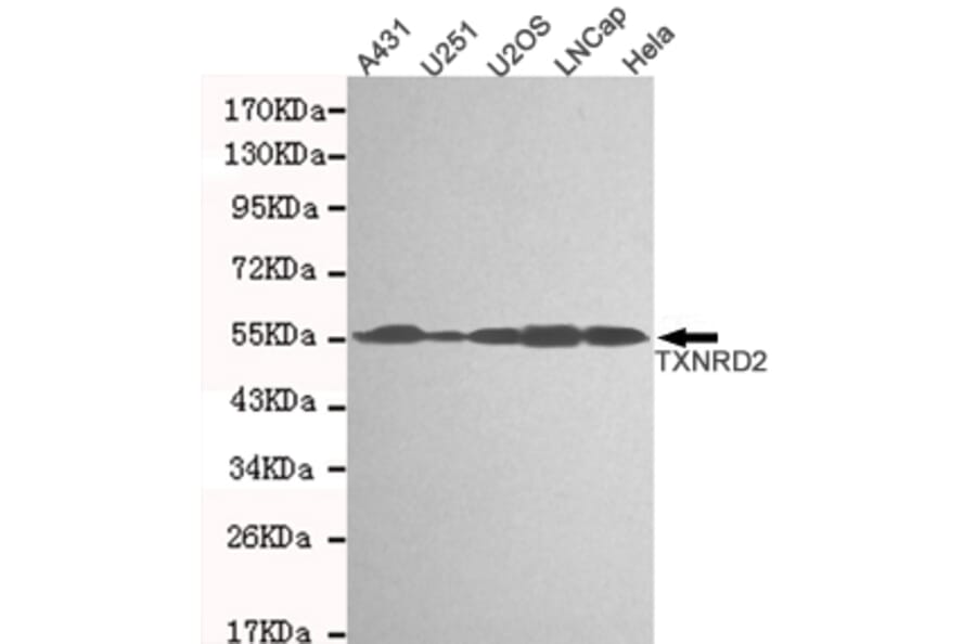 Western blot - TXNRD2 Monoclonal Antibody from Signalway Antibody (27123) - Antibodies.com
