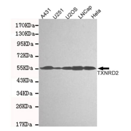 Western blot - TXNRD2 Monoclonal Antibody from Signalway Antibody (27123) - Antibodies.com
