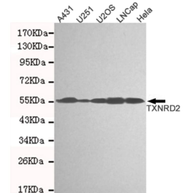 Western blot - TXNRD2 Monoclonal Antibody from Signalway Antibody (27123) - Antibodies.com
