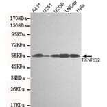 Western blot - TXNRD2 Monoclonal Antibody from Signalway Antibody (27123) - Antibodies.com