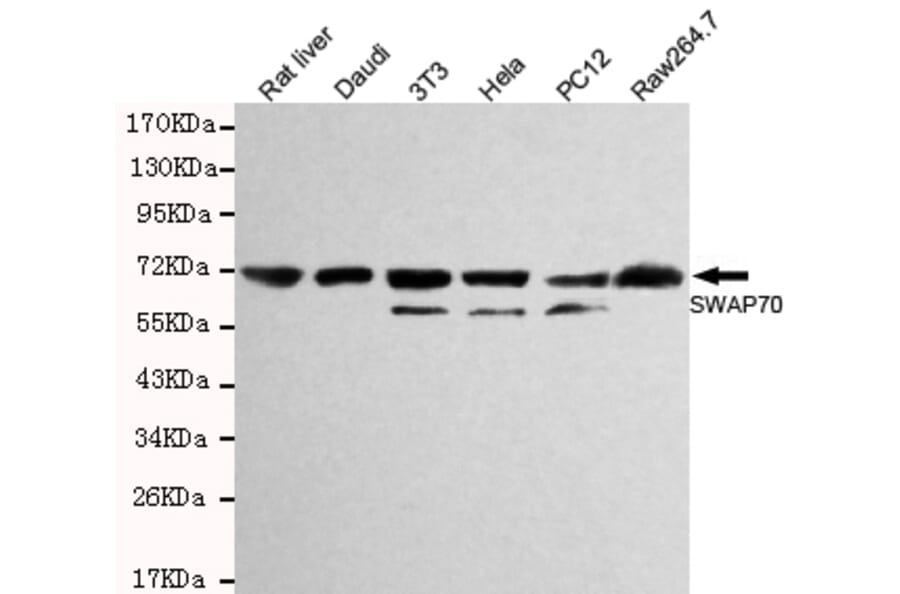 Western blot - SWAP70 Monoclonal Antibody from Signalway Antibody (27126) - Antibodies.com