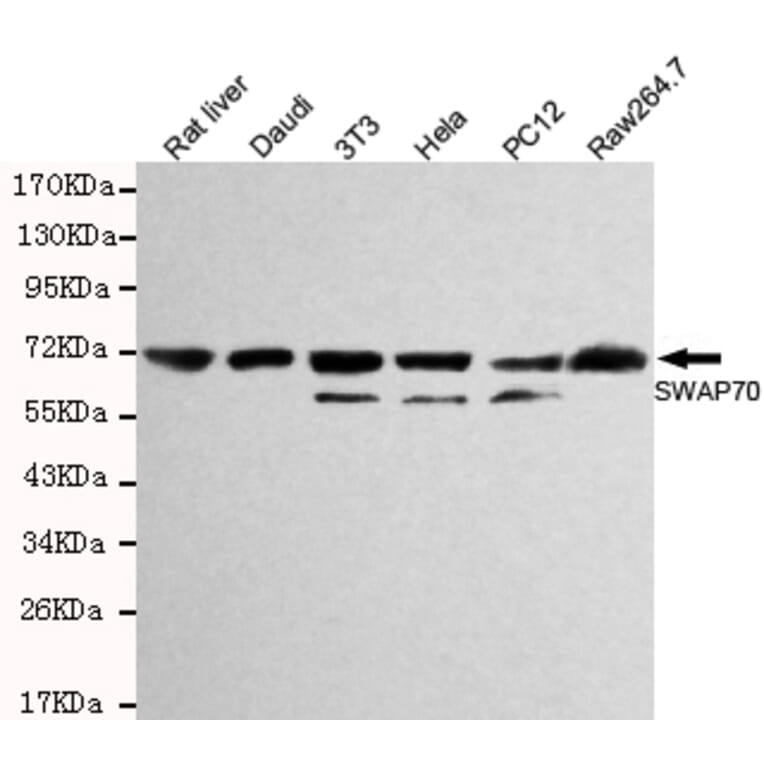 Western blot - SWAP70 Monoclonal Antibody from Signalway Antibody (27126) - Antibodies.com