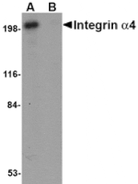 Western blot - Integrin alpha 4 Antibody from Signalway Antibody (24748) - Antibodies.com