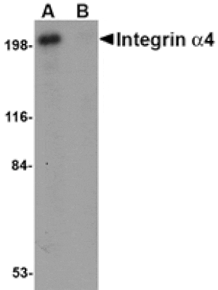 Western blot - Integrin alpha 4 Antibody from Signalway Antibody (24748) - Antibodies.com