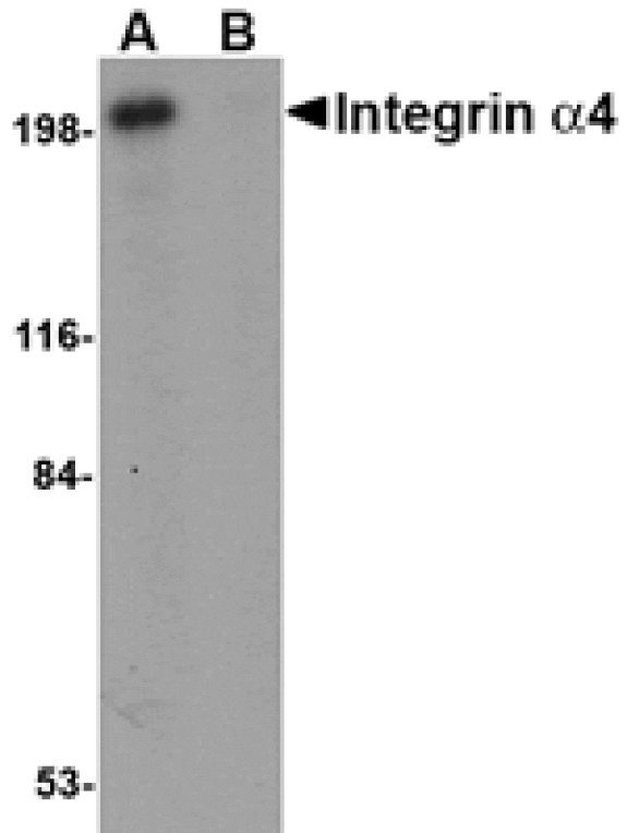 Western blot - Integrin alpha 4 Antibody from Signalway Antibody (24748) - Antibodies.com