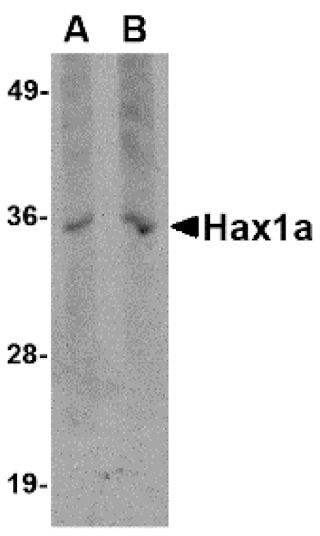 Western blot - Hax1a Monoclonal Antibody from Signalway Antibody (26022) - Antibodies.com