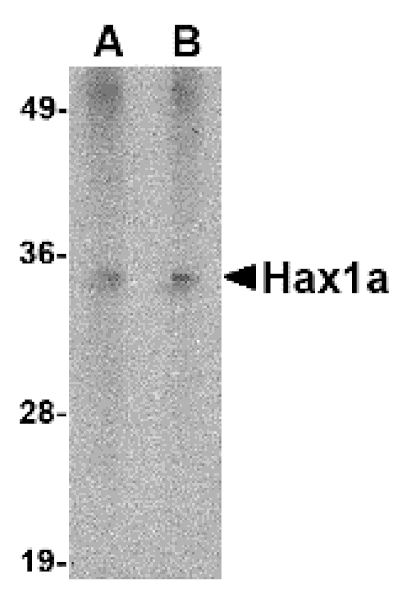 Western blot - Hax1a Monoclonal Antibody from Signalway Antibody (26023) - Antibodies.com