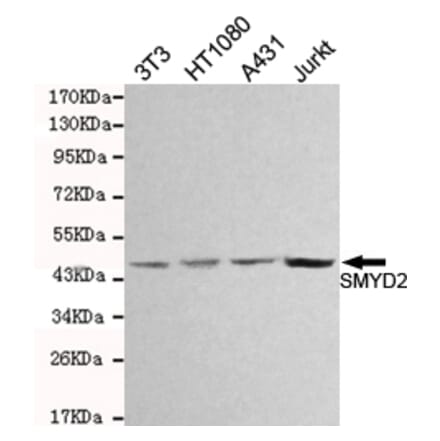 Western blot - SMYD2 Monoclonal Antibody from Signalway Antibody (27084) - Antibodies.com
