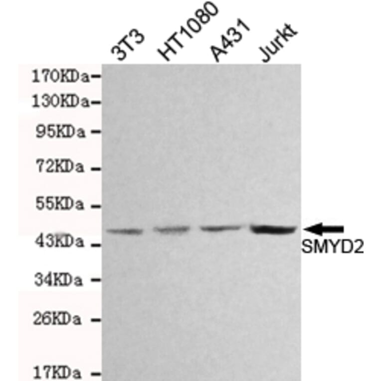 Western blot - SMYD2 Monoclonal Antibody from Signalway Antibody (27084) - Antibodies.com