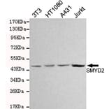 Western blot - SMYD2 Monoclonal Antibody from Signalway Antibody (27084) - Antibodies.com