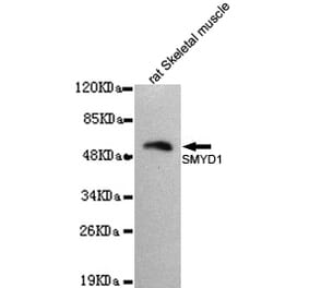 Western blot - SMYD1 Monoclonal Antibody from Signalway Antibody (27088) - Antibodies.com