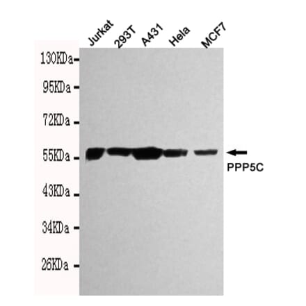 Western blot - PPP5C Monoclonal Antibody from Signalway Antibody (27096) - Antibodies.com