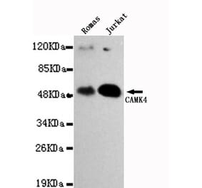 Western blot - CAMK4 Monoclonal Antibody from Signalway Antibody (27103) - Antibodies.com