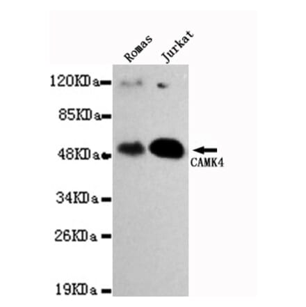 Western blot - CAMK4 Monoclonal Antibody from Signalway Antibody (27103) - Antibodies.com